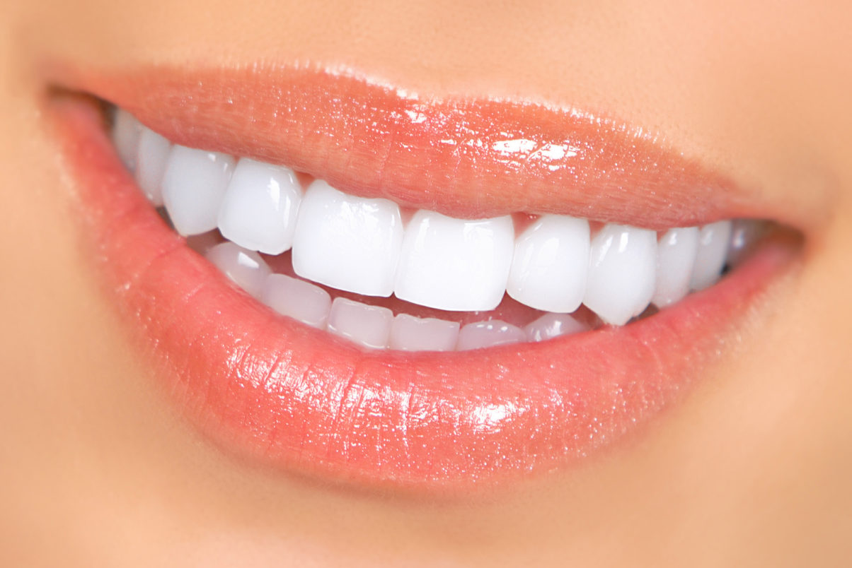 Facts about teeth whitening